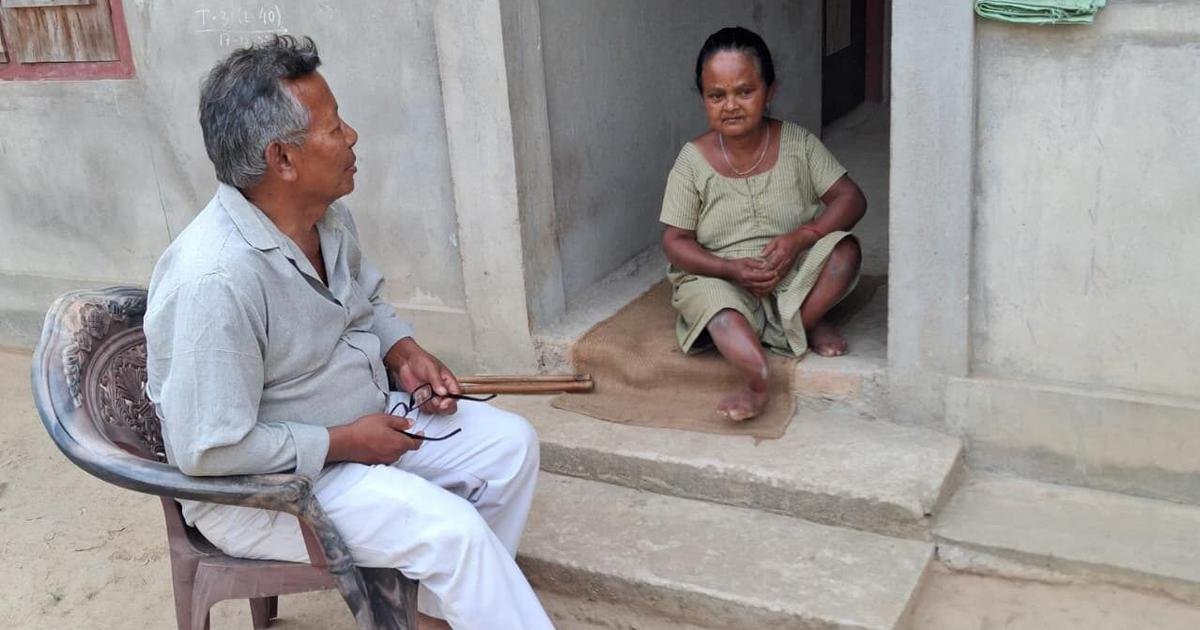 Assam: Excess fluoride in groundwater is causing bent limbs, body deformation